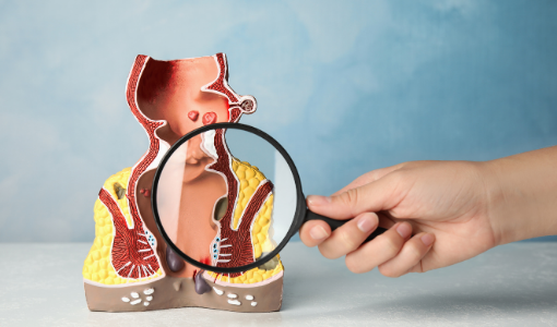Piles, Fissure & Fistula Hospital Wakad