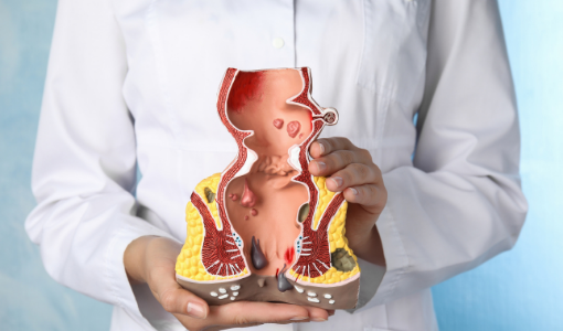 Piles, Fissure & Fistula Hospital Wakad